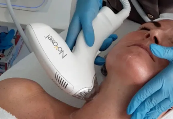 Downtime & Recovery: Tixel’s Quick, Lasers Take Weeks