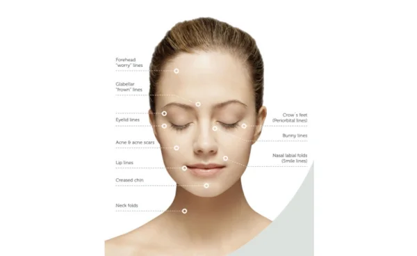 Cost of Tixel treatment