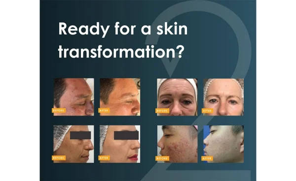 What to expect from Tixel