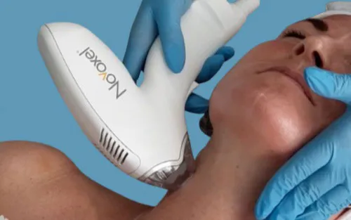 The Tixel Treatment Process - What To Expect