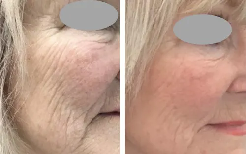 what to expect and when Image