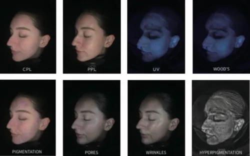 Skin Analysis Imaging? Image