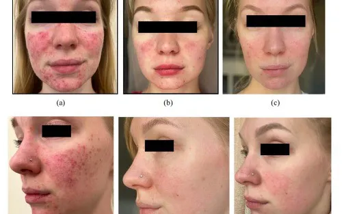 Can It Be Used For? Image