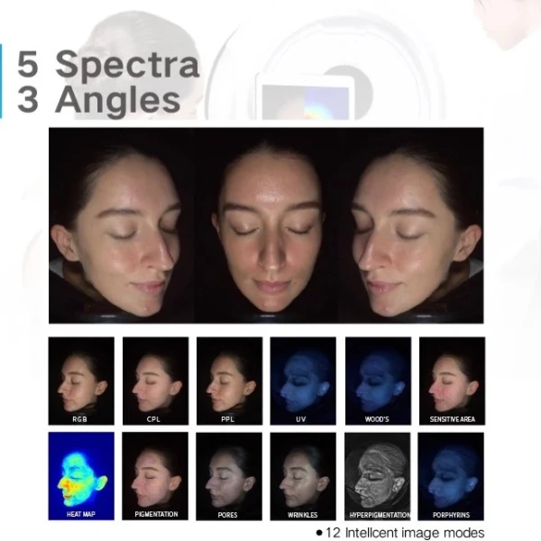 £500 off any skin analysis device in October