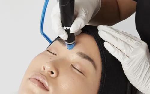 What Is Hydrafacial and How Does It Work?