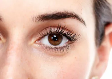 Brow Lift (Surgical)