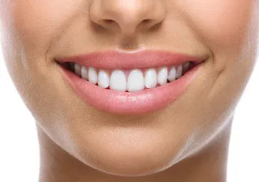 Dental Veneers (Teeth) clinics