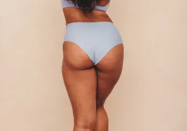 Cellulite Treatment (Mechanical Massage) clinics