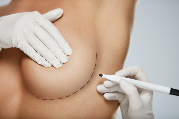 Breast Implants/Breast Augmentation Procedure, Cost, Risks, UK Clinics Info Image