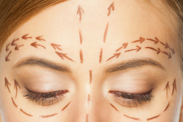 Surgical Brow or Forehead Lift Information Image