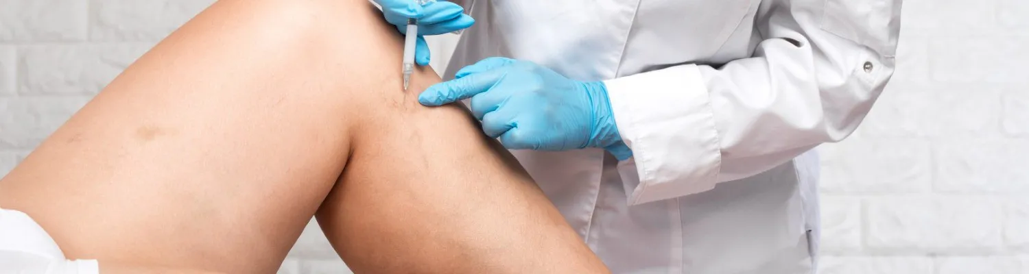thread vein