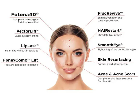 Fotona® Lasers  (SP Dynamis, etc.)