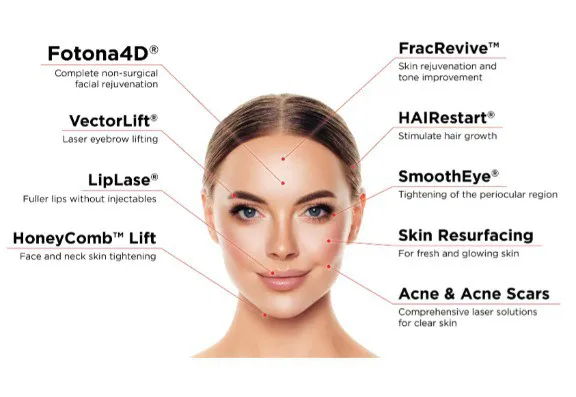 Fotona® Lasers  (SP Dynamis, etc.)