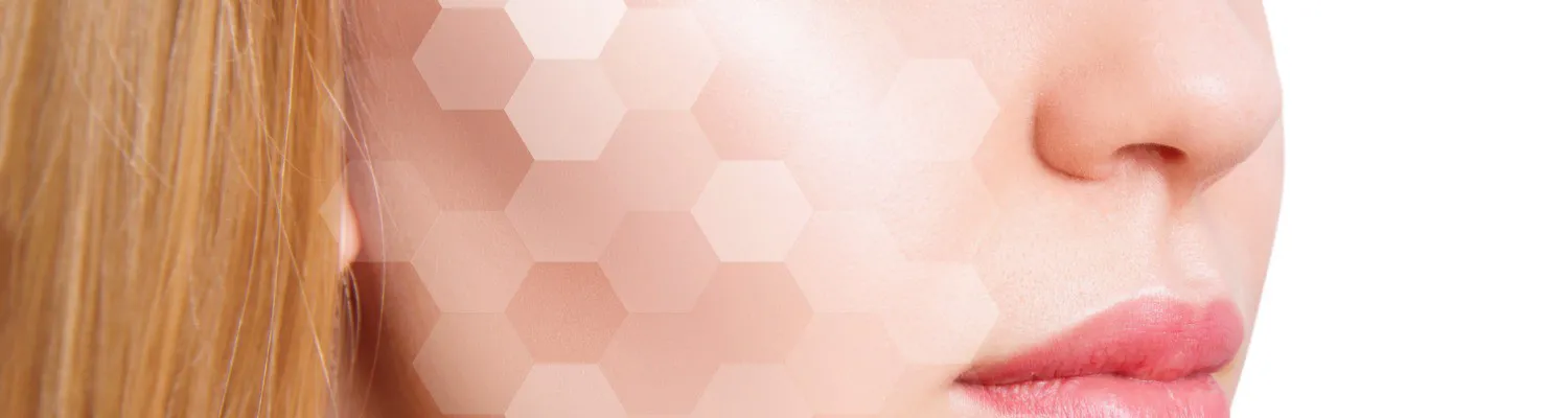 Acne Treatment Is Evolving