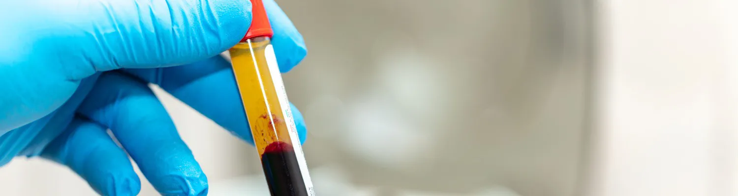 New PRP FAQ Now Live, and How Clinics Can Use It