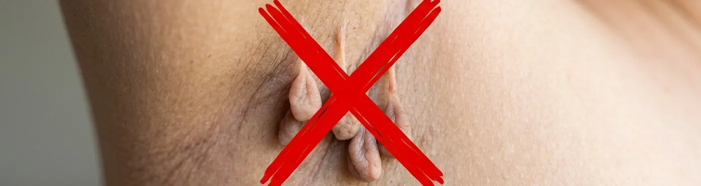 New Skin Tag Removal FAQ Now Live, and How Clinics Can Use It