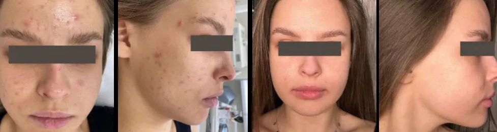 What Is LDM… Live Webinar | 4th June 1pm