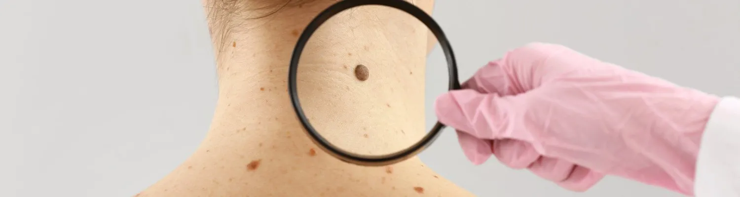 What is Teledermatology?