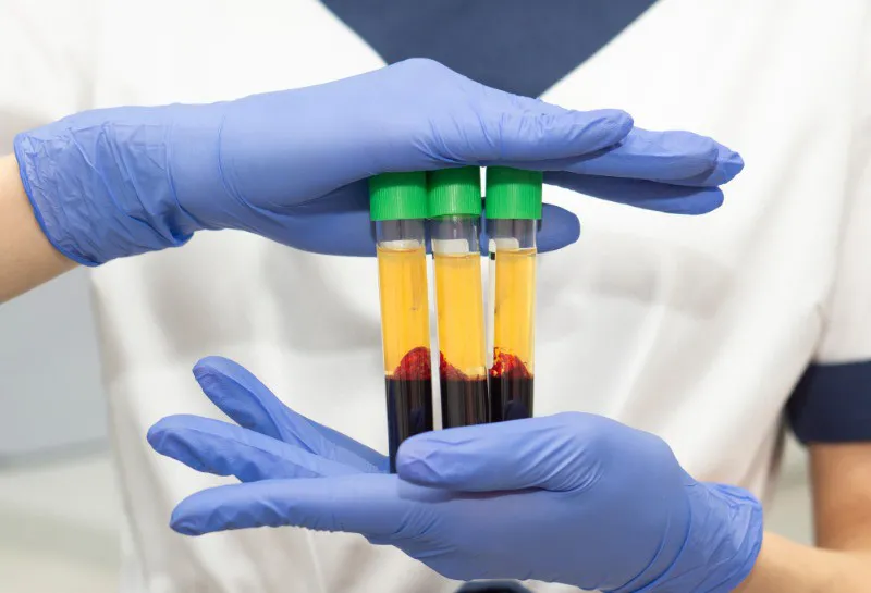 A Milestone For PRP Safety