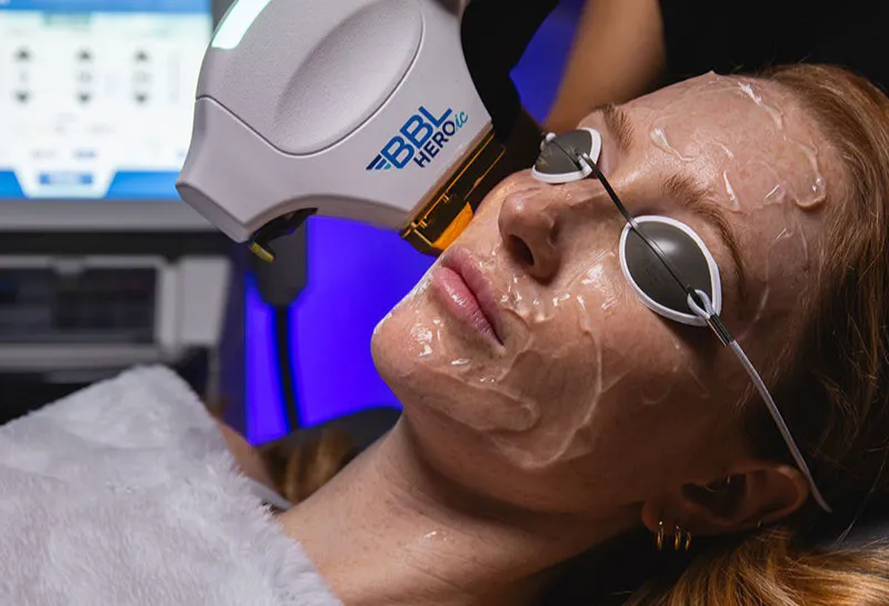 Dr Nina Bal Introduces Sciton’s BBL HEROic™ for Next-Level Skin Rejuvenation