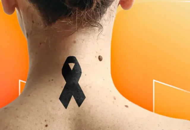 Face the Future Announces Partnership With Leading UK Skin Cancer Charity Skcin
