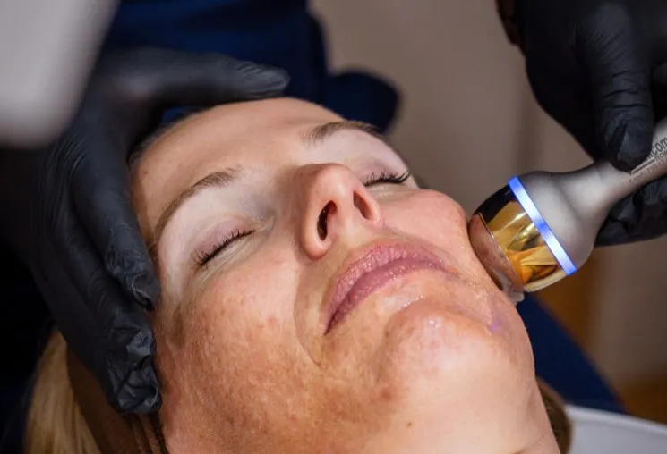Skin Laxity After GLP-1 Weight Loss: What's Happening and How to Treat It