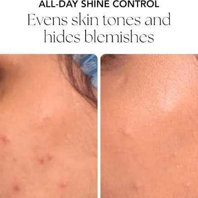 Oxygenetix - Oil Control Foundation