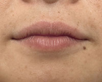 Female lips before micropigmentation