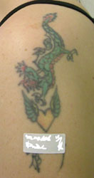 Laser Tattoo Removal - Professional Tattoo Before
