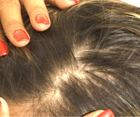 Female hair before treatment