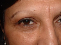Eyebrow on female before micropigmentation