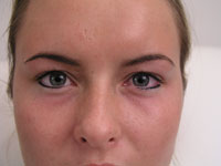 Eyeliner on a female after micropigmentation
