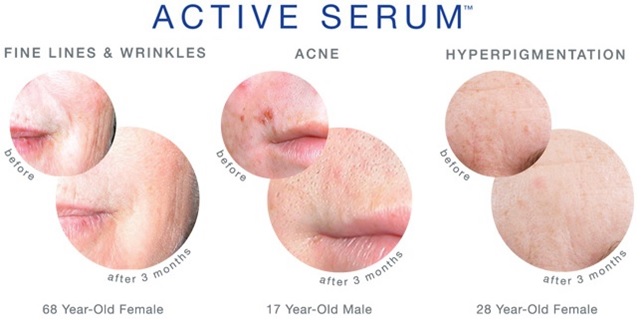 Active Serum Before and After Data